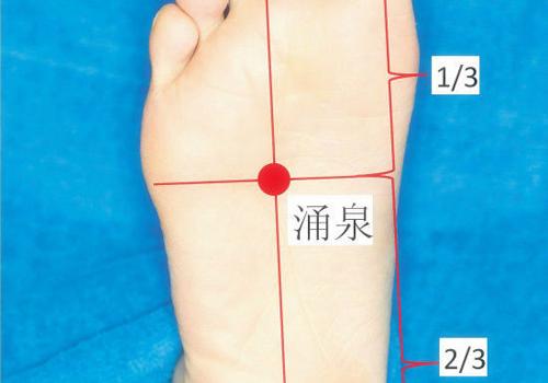 抑郁症艾灸哪里最好 以下穴位帮你缓解抑郁症