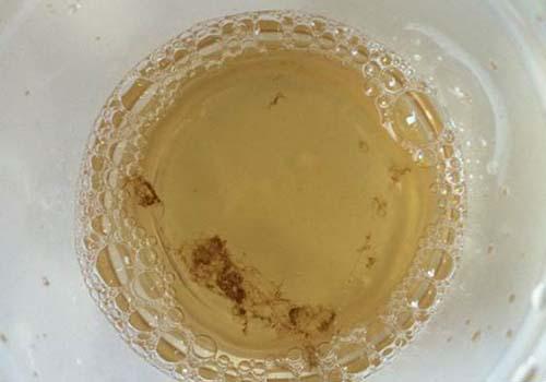 漱口水吐出黑色的东西是什么,漱口水吐出来的