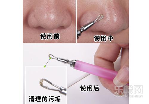 粉刺针的正确用法图示,粉刺针怎么用,粉刺针的