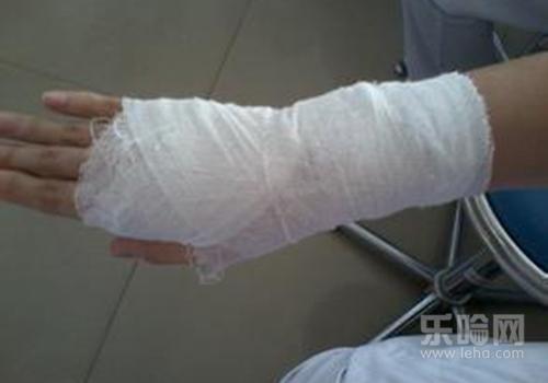 贫血是什么原因造成的,贫血的原因,贫血是怎么