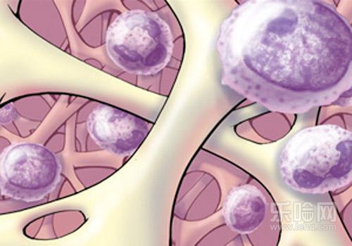 白血病骨髓移植后能活多久,白血病骨髓移植成