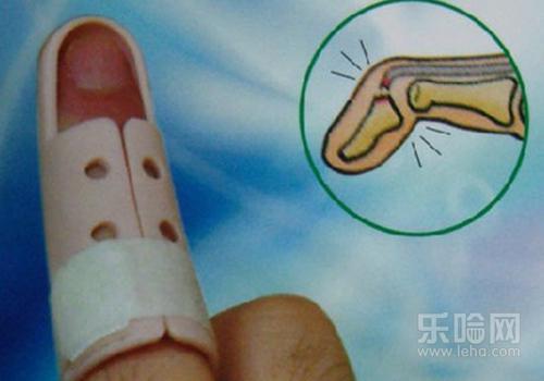 脱臼和骨折有什么区别,骨折和脱臼的区别,脱位