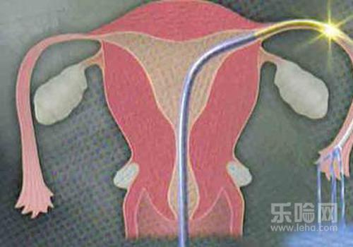 输卵管堵塞做造影疼吗,输卵管造影痛不痛-乐哈