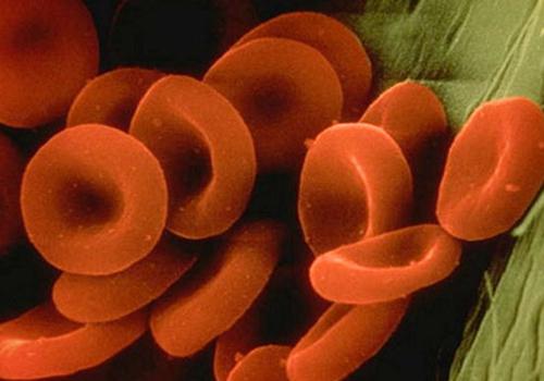 红细胞计数偏低是什么原因,红细胞计数偏低是