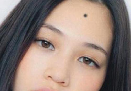 点痣了不能吃什么,点痣后不能吃哪些食物,点痣