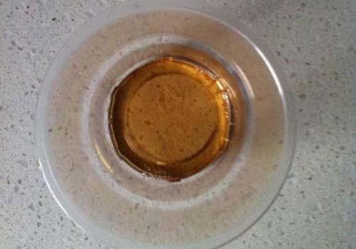 漱口水吐出黑色的东西是什么