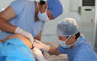 提肛运动能治疗痔疮吗