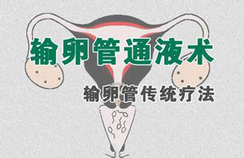 输卵管通液术