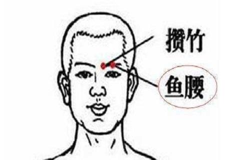 鱼腰的针刺方法 鱼腰针刺方向 乐哈健康网 鱼腰的针刺方法 鱼腰针刺方向 乐哈健康网