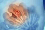 乳腺增生刮痧管用吗 “乳腺增生”怕刮痧，刮刮就软了！