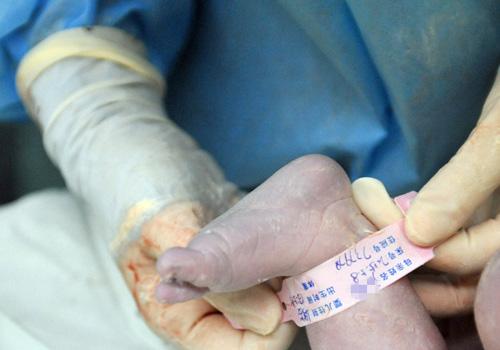 分娩方式有哪些