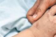 烫伤怎么才能不留疤痕 烫伤后怎么护理