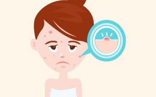 吃大蒜去湿气吗