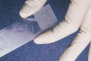 HPV检查取样后有点血 HPV检查后出血正常吗