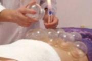 腹痛拔罐治疗方法 肚子疼拔罐拔什么位置