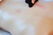 刮痧排毒的原理是什么 排毒刮痧刮哪里
