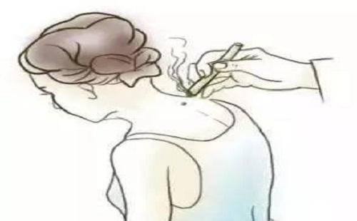 黄疸艾灸哪里,黄疸应该如何艾灸-乐哈健康网