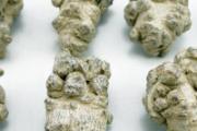 男性健康知识 男人的这些毛病，再不重视就晚了！