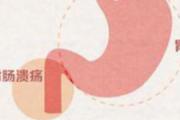 胃溃疡症状表现有哪些 胃溃疡饮食注意事项