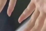 双手发麻怎么回事 双手发麻的原因