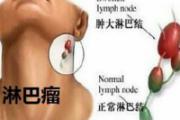 肺癌究竟是如何转移的