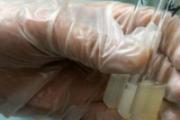 精子果冻一样怎么回事