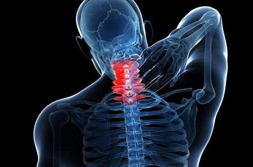 缓解颈椎疼痛的瑜伽动作