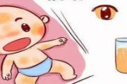 母乳性黄疸降了又升怎么办 母乳性黄疸该如何退黄