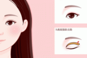疤痕体质能做双眼皮手术吗 疤痕体质能做全切双眼皮吗