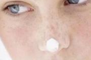 脸上有斑怎么办 6方法帮你消除脸部斑点