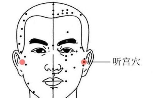 4听宫主治疾病1.听宫主要用于治疗和耳朵及听5听宫对症按摩疗法1.