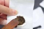 三伏贴小孩可以贴吗 三伏贴几岁宝宝可以贴