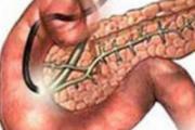 急性胰腺炎的治疗方法