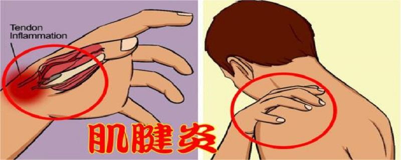 手腕突然疼痛没有受伤 用不上力是怎么回事?怎么办?