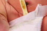 新生儿肚脐不小心扯掉了怎么办 妈妈不慌！教你4步处理好！