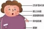 多囊卵巢综合症表现 这些备孕秘诀你知道吗
