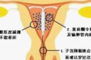 产后什么时候上环最合适