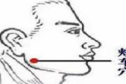 颊车的针刺方法 颊车怎么针灸