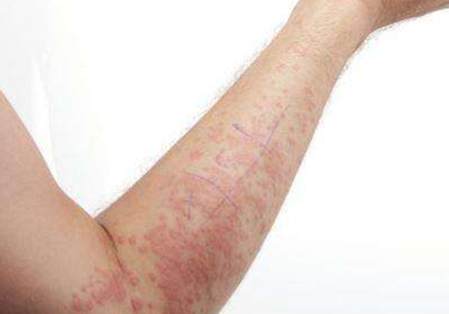 川端己街发布的养生攻略_用户中心-乐哈健康网