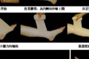 静脉曲张手术后注意事项