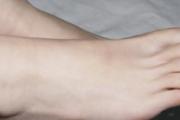 身体缺乏营养的症状 原来可以这样改善