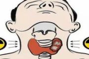 甲状腺癌的发病原因是什么 甲状腺癌怎么确诊
