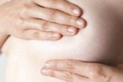 乳腺增生会不会变成乳腺癌