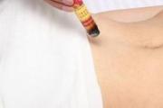 艾灸可以治疗乳腺增生吗