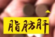 脂肪肝对人体的危害有多大 没想到脂肪肝的危害居然这么大