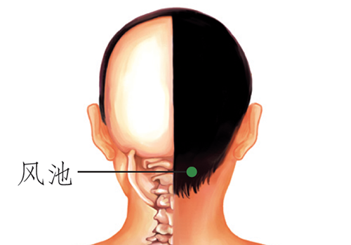 压痛拔罐位置示意图 压痛拔罐方法