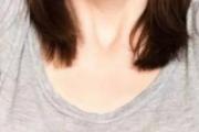 夏季腋下出汗怎么办 如何止汗杀菌治狐臭