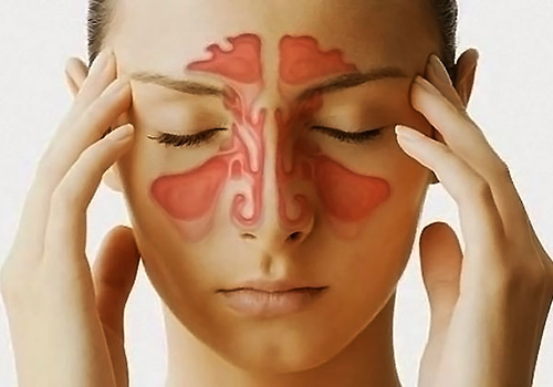 鼻子流黄水需及时检查