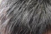 白发是什么原因造成的 白发与身体的关系