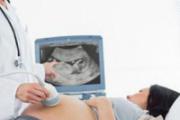 5个月孕妇检查什么项目 这些准妈妈要知道